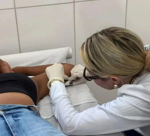 Saúde da mulher ganha reforço com implante contraceptivo de longa duração nas UBS